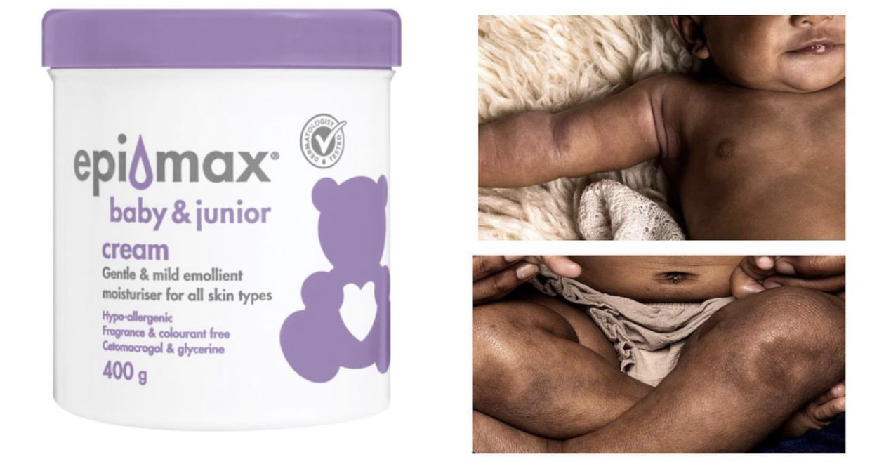 Epimax Junior Creme Antialérgico 400g