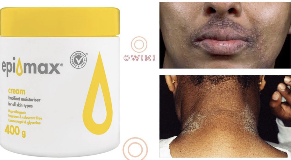 Epimax 125g Creme Antialérgico Adulto