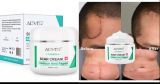 Creme para Cicatriz 